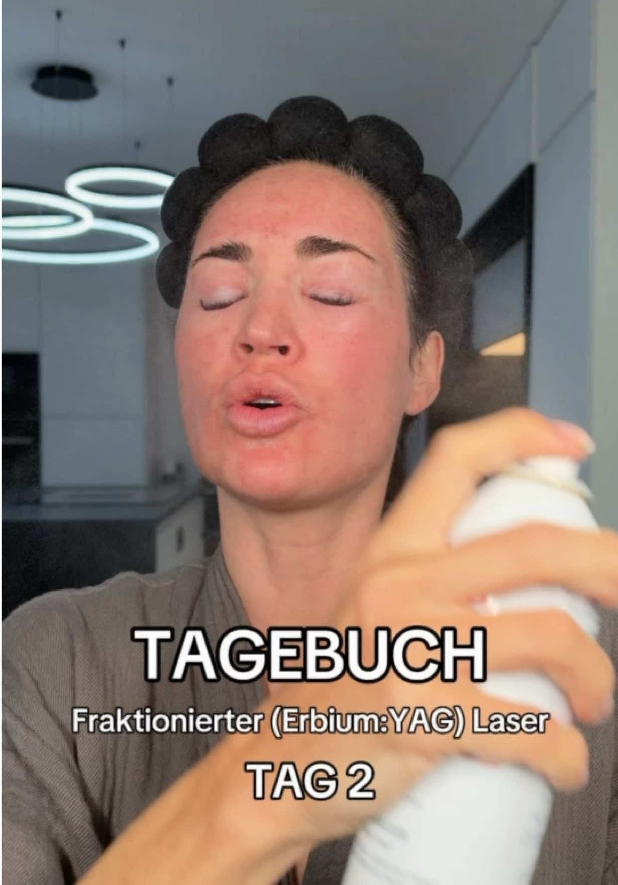 @Melissa | BEAUTYEXPERT