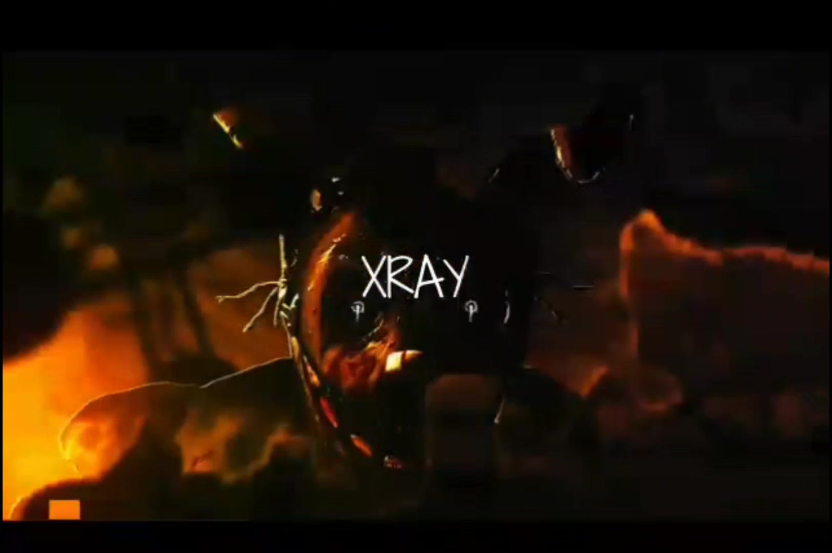 @Normal Xray.