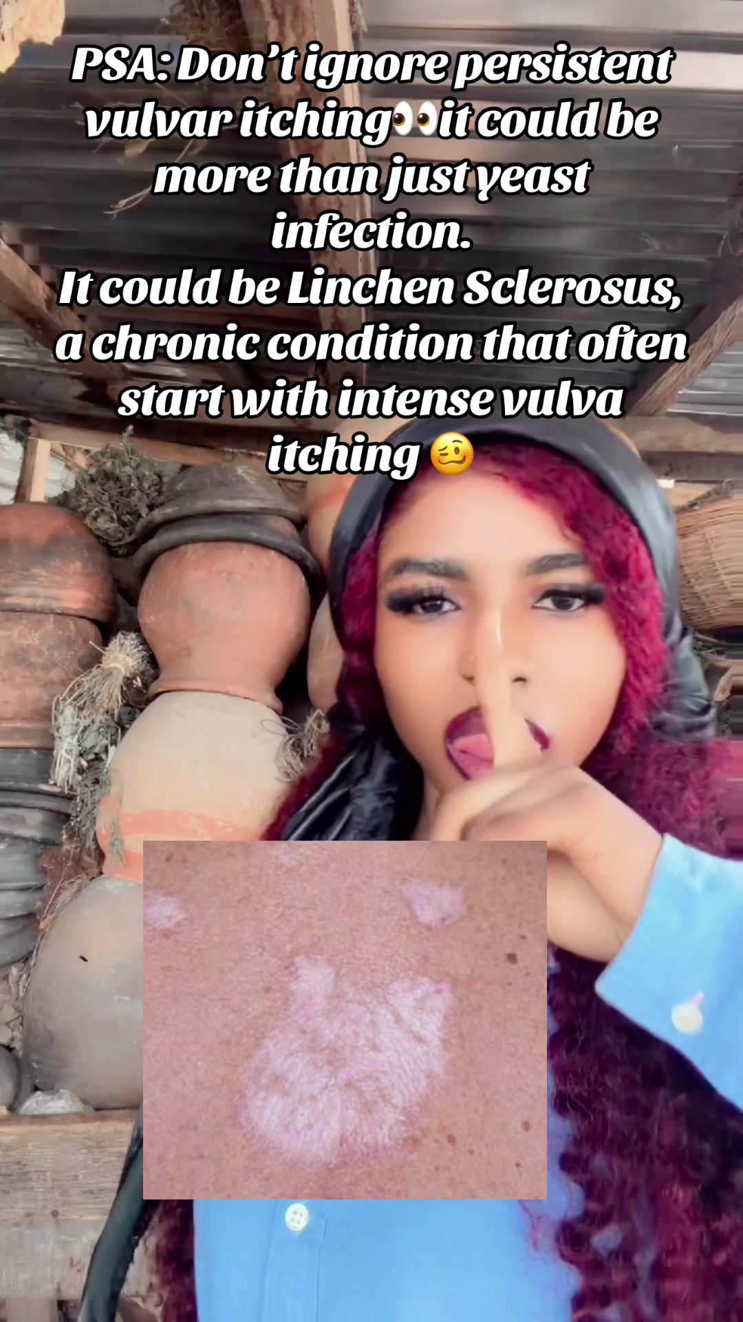 @GeNz_alagbo🐍🍯