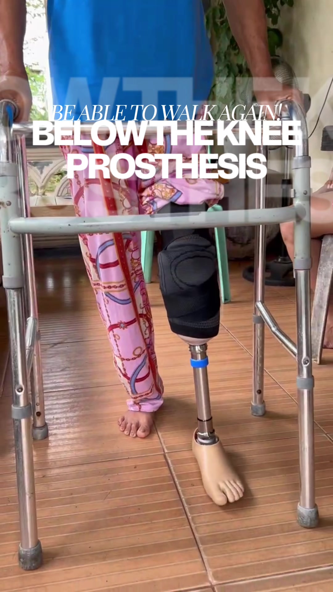 @Ogette Prosthetics & Orthotics