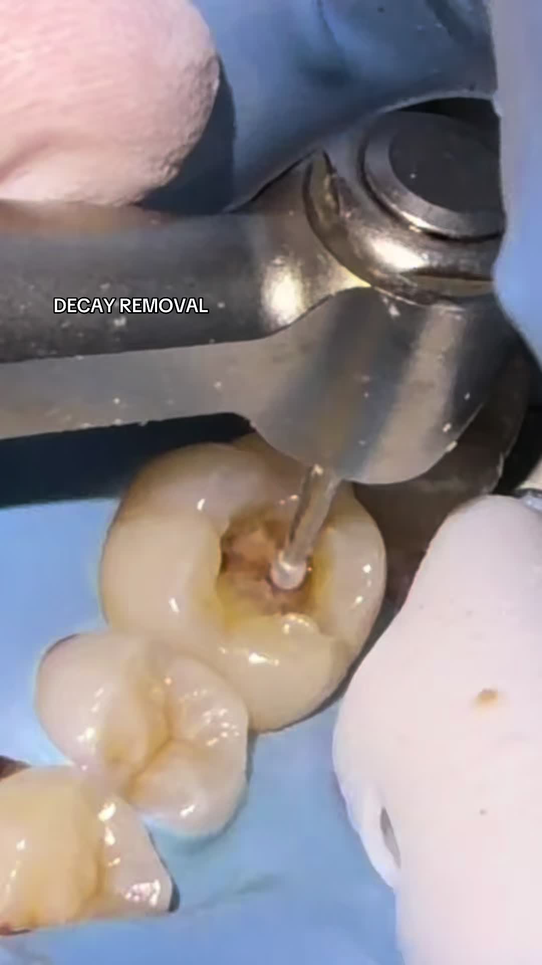@Hello Dental