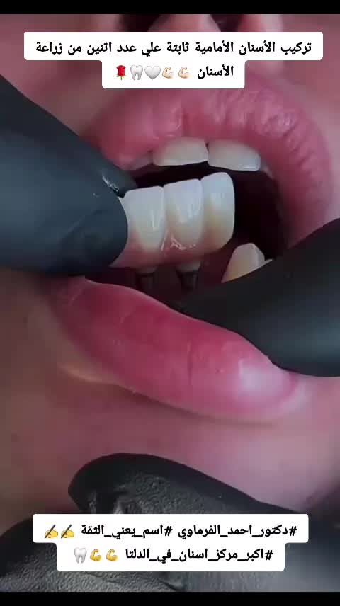 @دكتور احمد طلعت الفرماوي