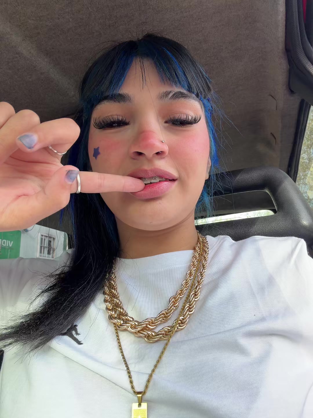 @Antocagnoni💙