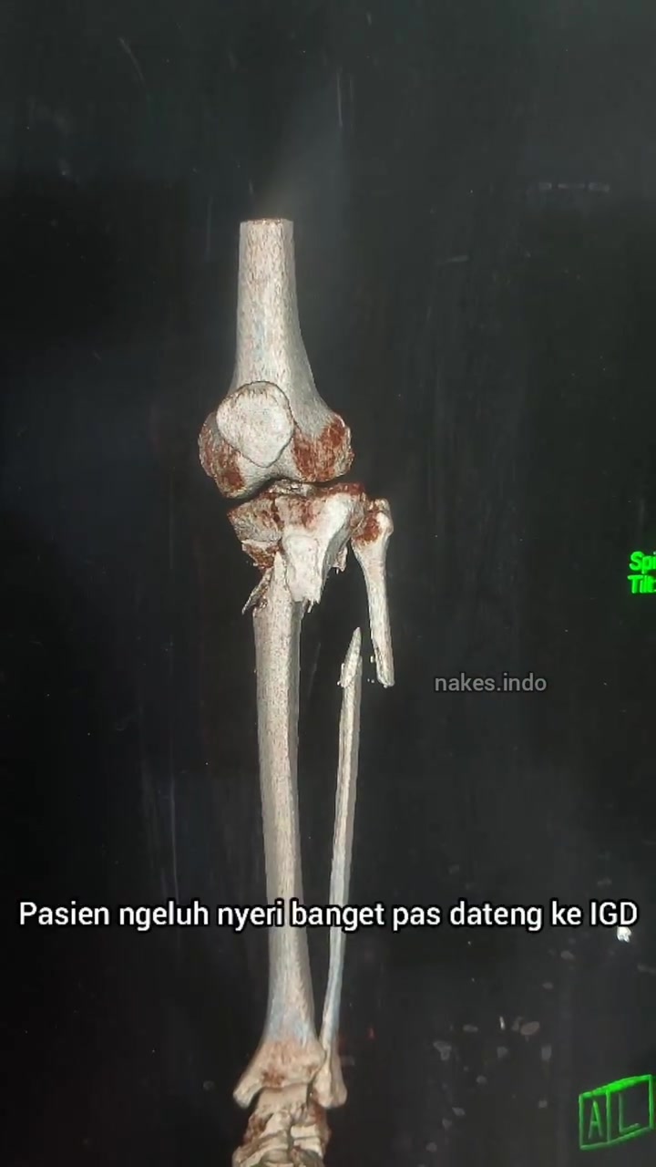 @Sobat Radiology