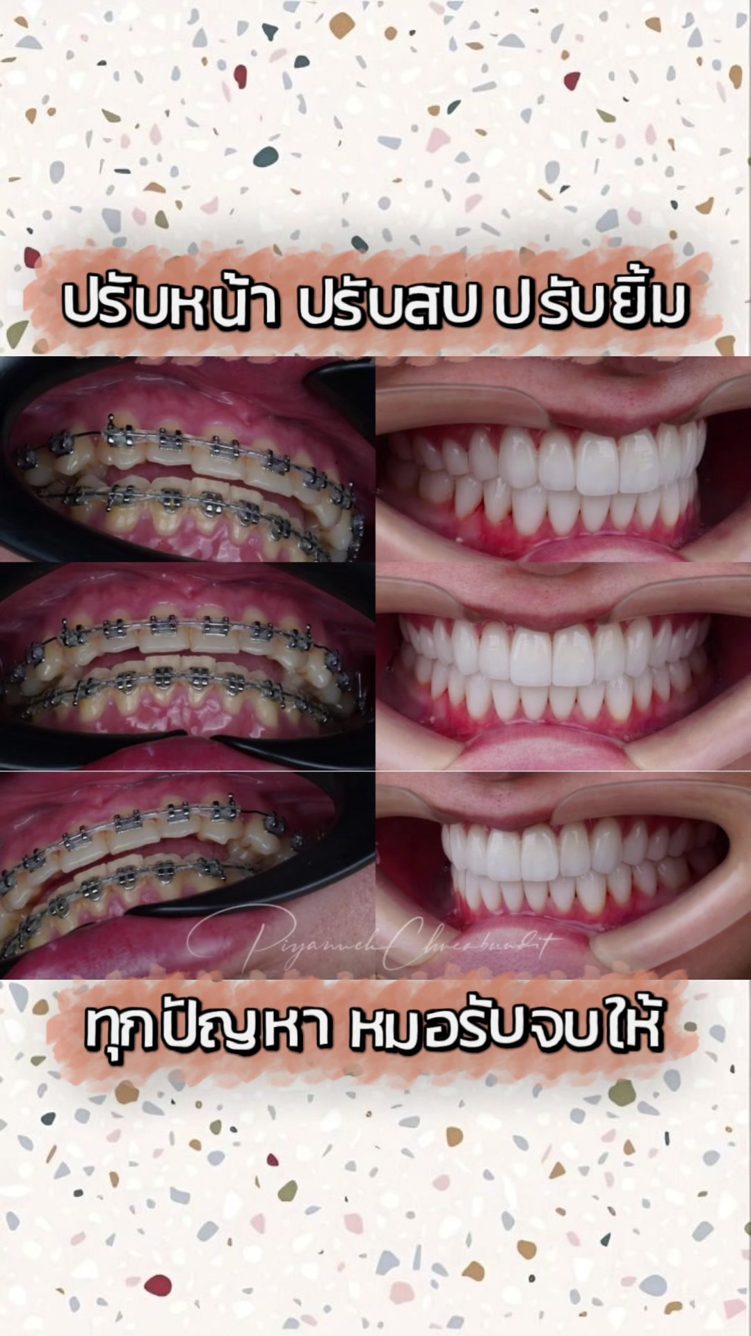 @smile Art Pattaya