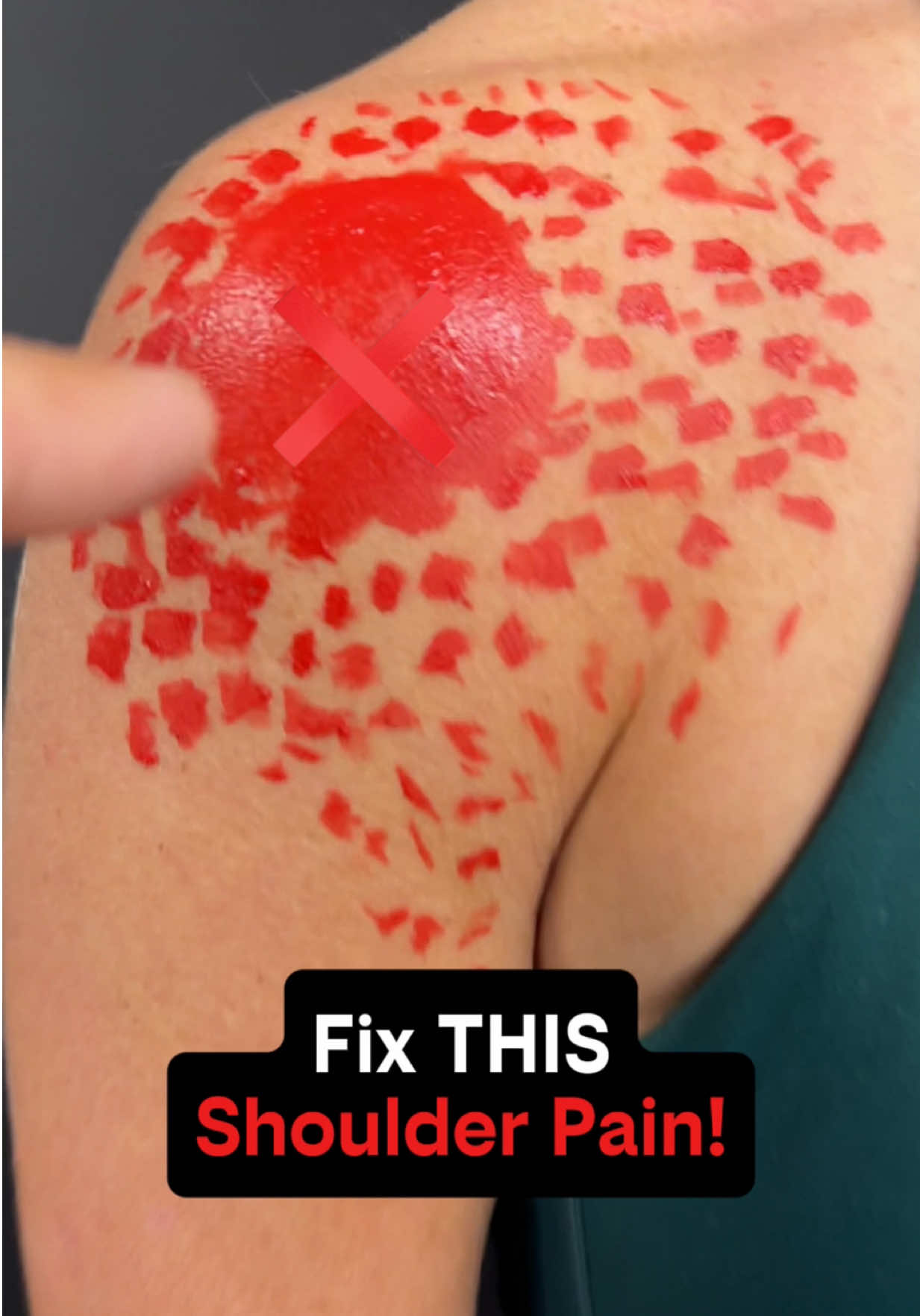 @Dr. Joe Damiani, DPT