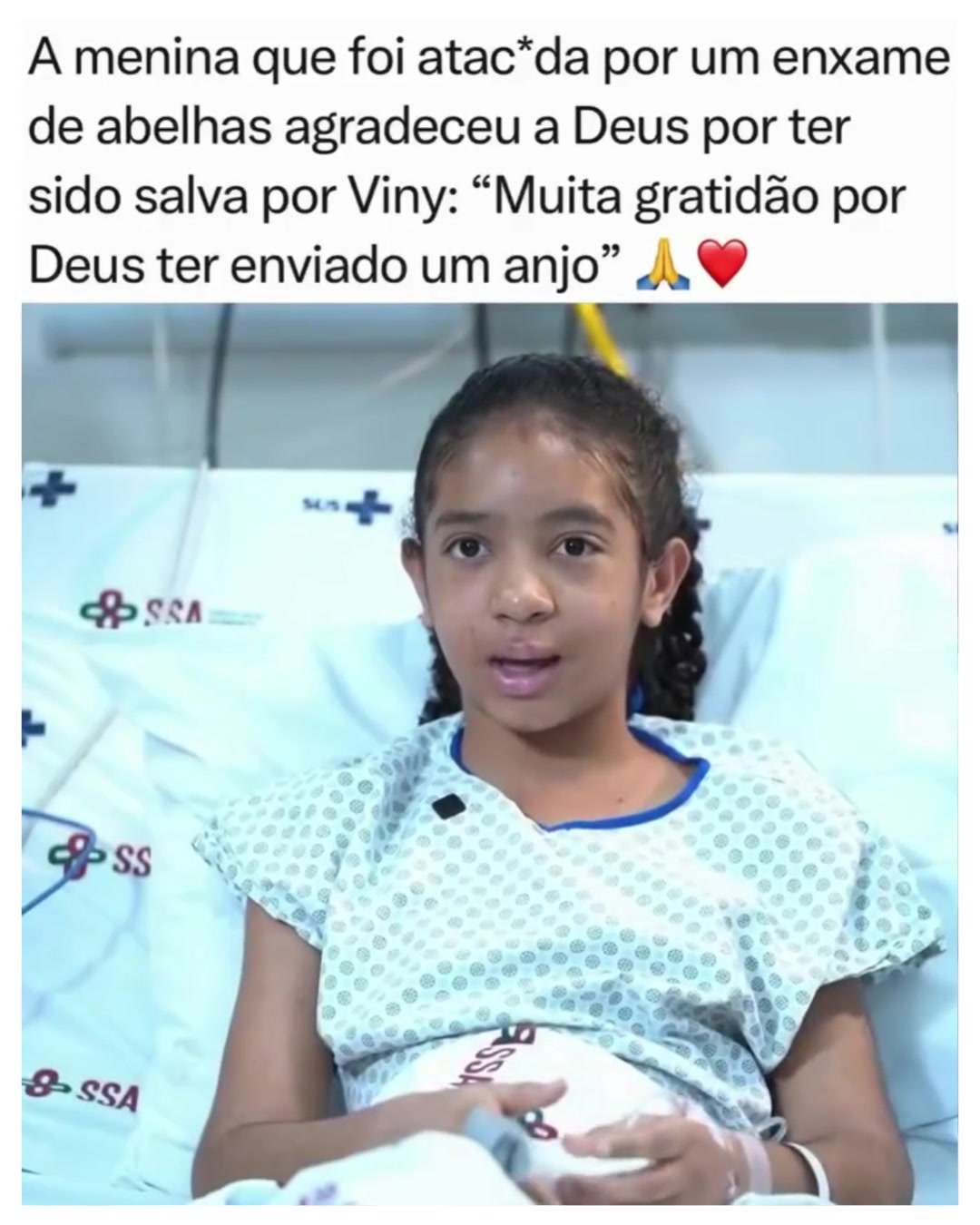 @Alfinetei