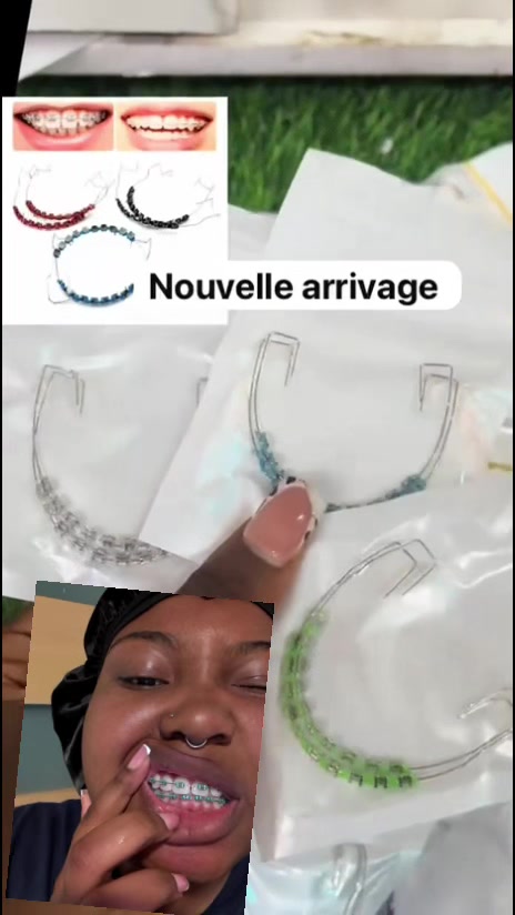 @fake appareil dentaire