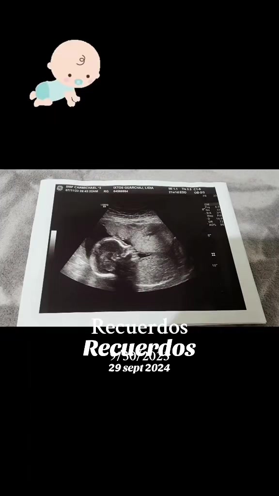 @Lidia Ixtos