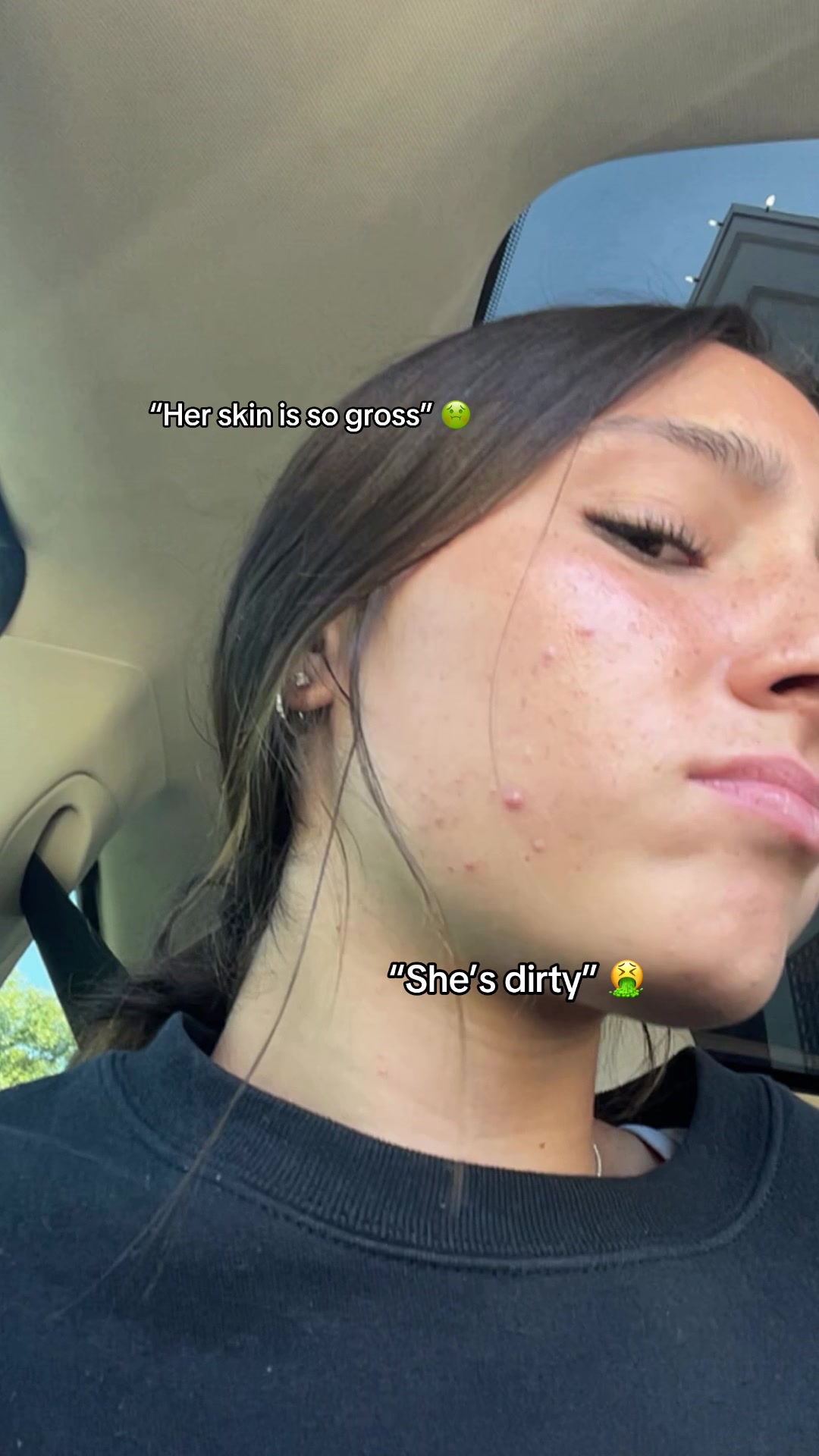@Lily