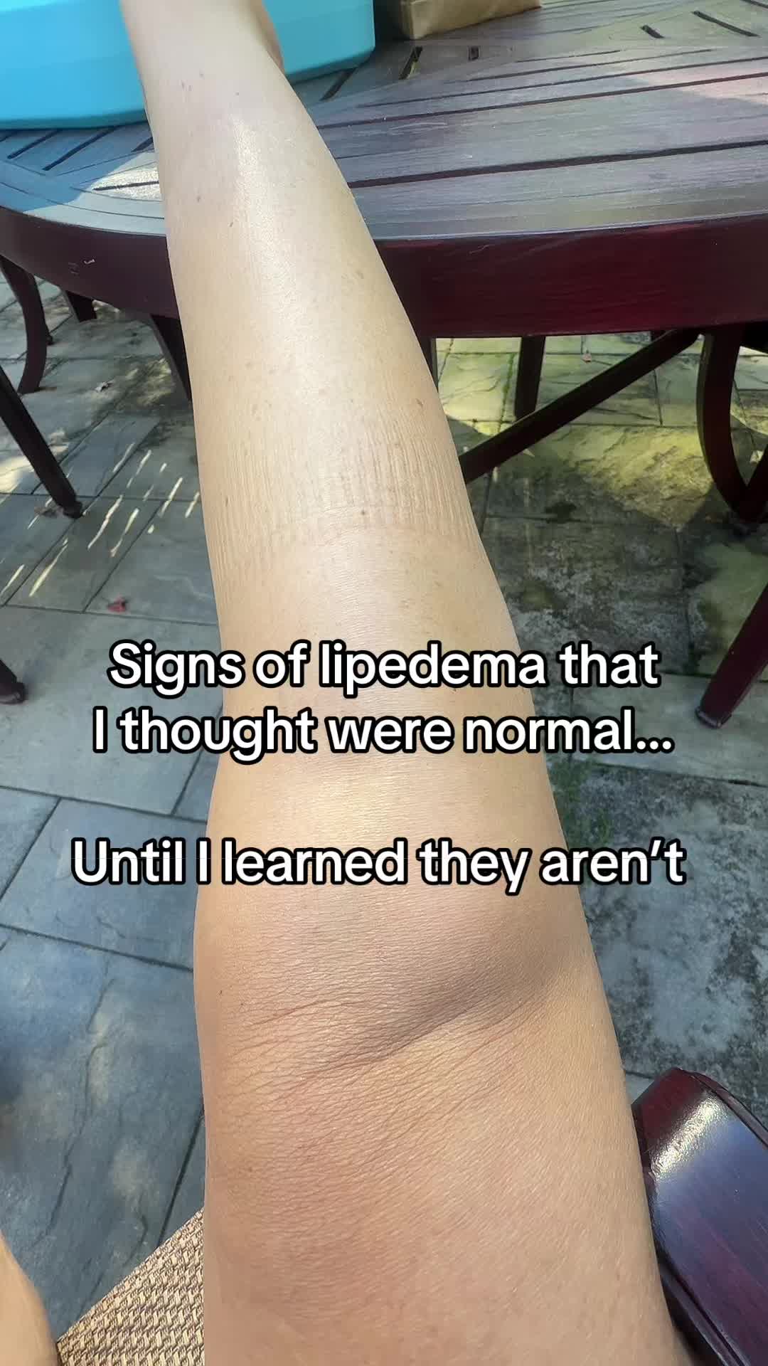 @Patty I Lipedema Lifestyle 💜