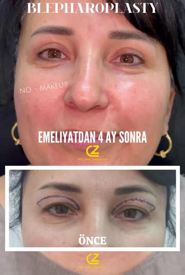 @Dr.Zamanov_Cemil
