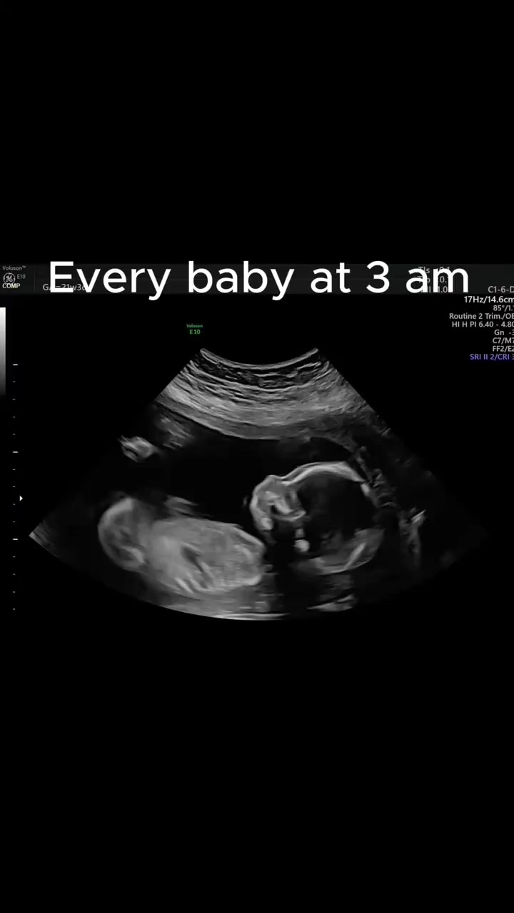 @Echobaby