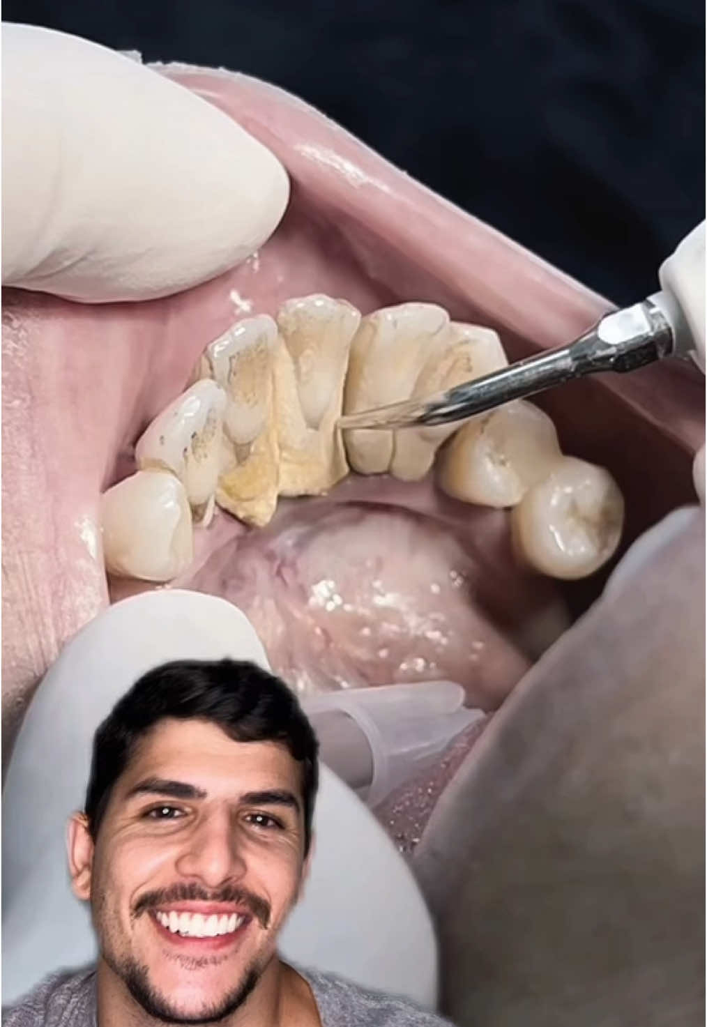 @Adriano Pacheco
