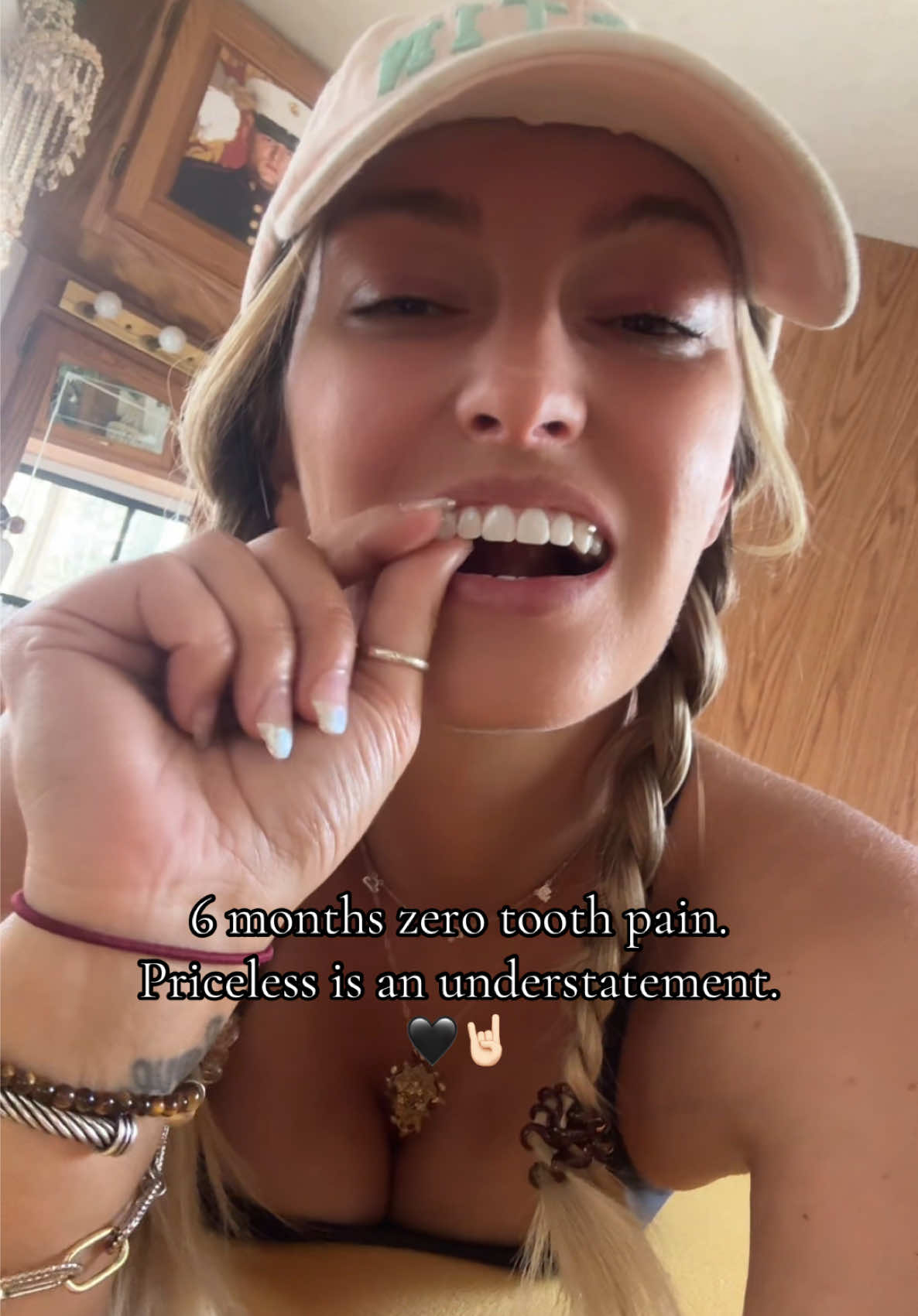@Sarah | Dentures | UGC | RVing