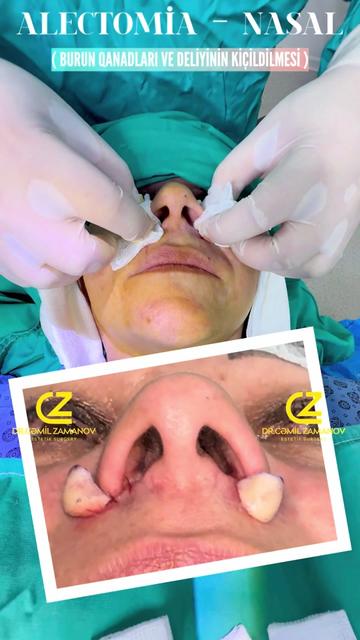 @Dr.Zamanov_Cemil