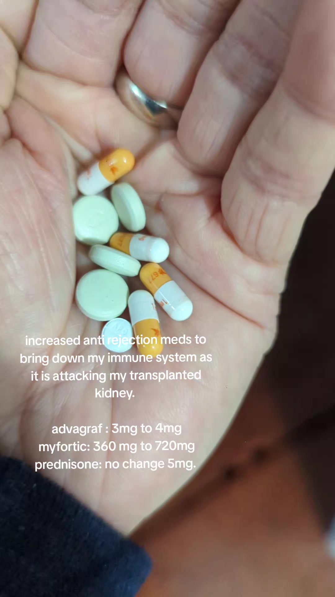 @my kidney journey (Loi)