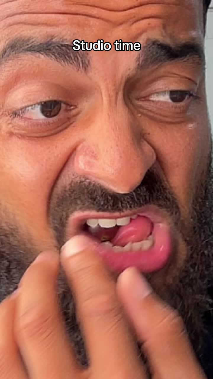 @Azz