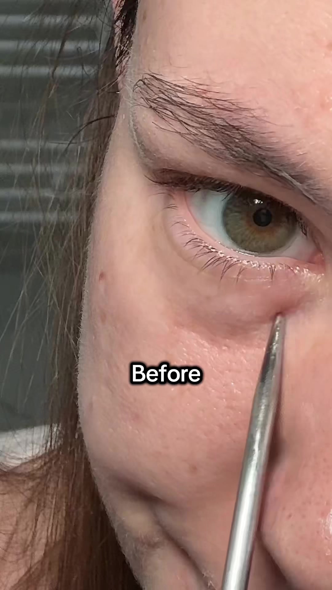 @watermelonsugarskin