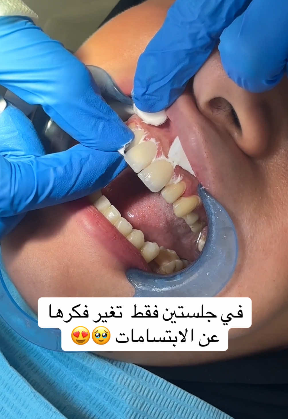 @Dr.ranaalsilani