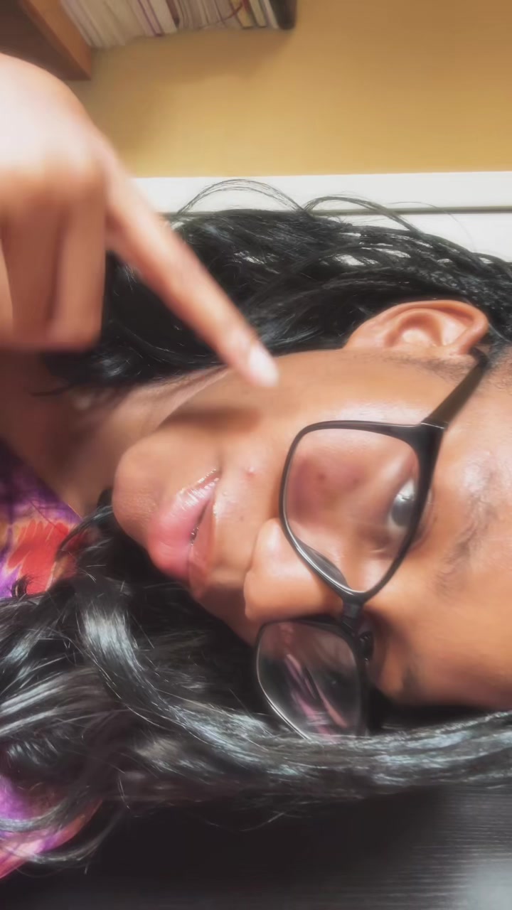 @Brace face 🥴