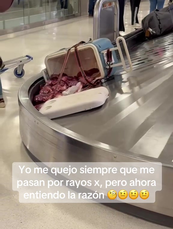 @Jose Luis Alvarez
