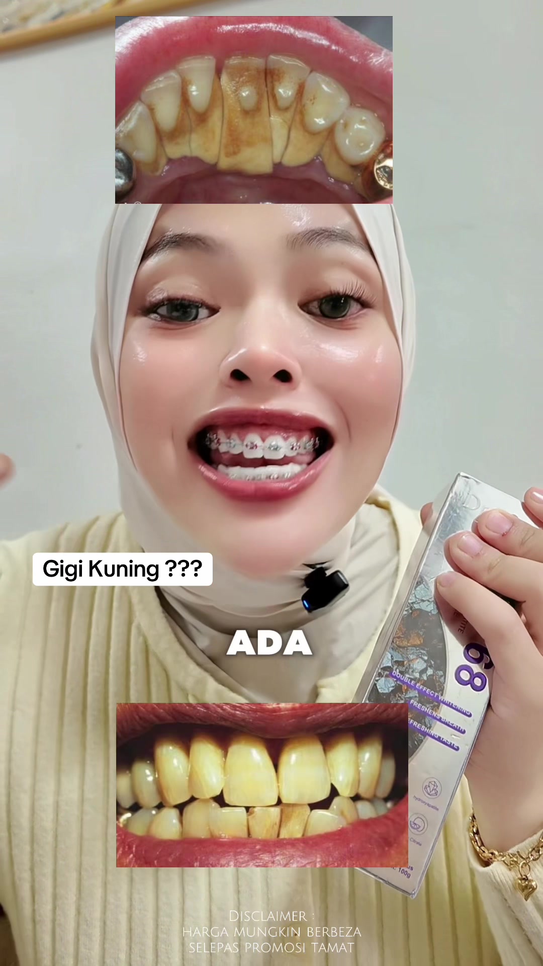 @Syaza Mahdir