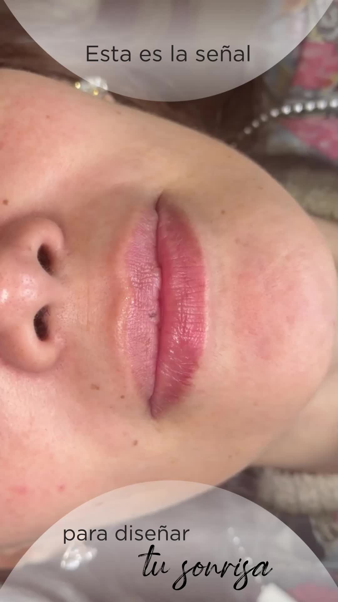 @Dr. NuriaOtero
