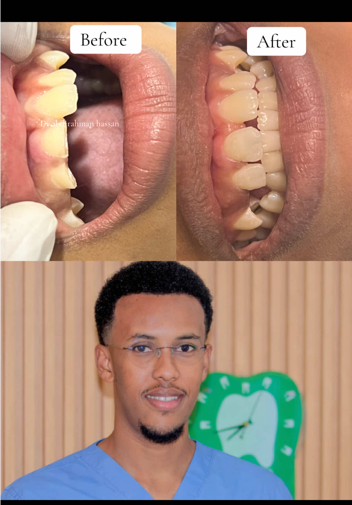 @Dr Abdirahman hassan laari
