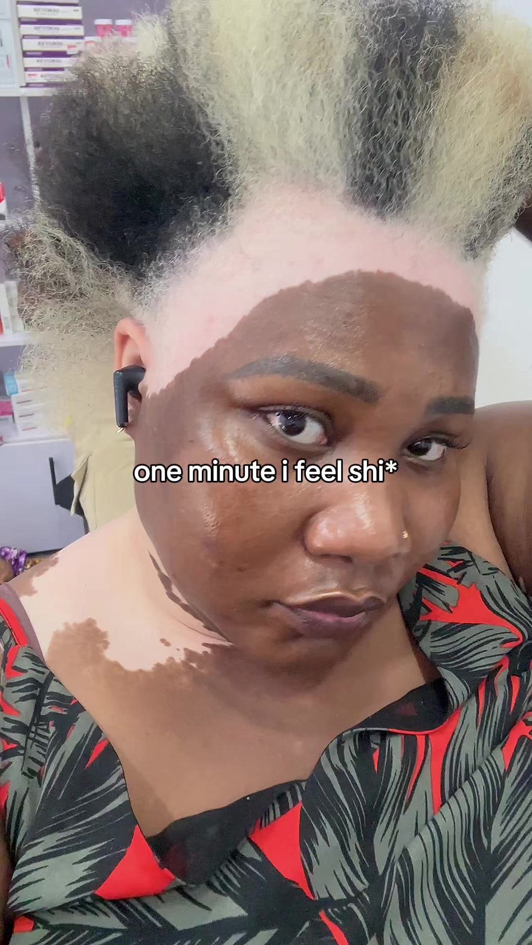 @Thevitiligogirl