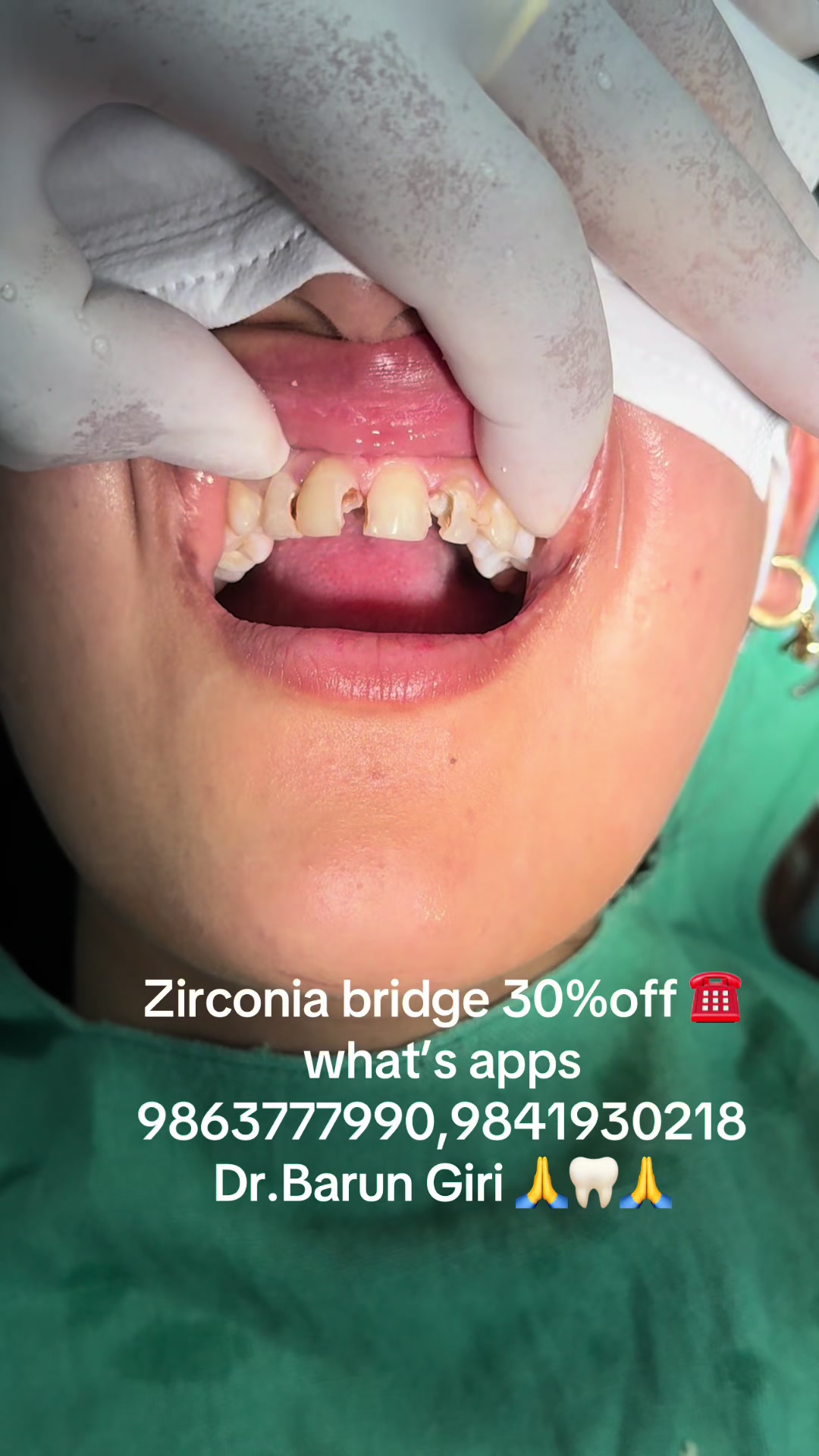 @Unique dental clinic Chabahil