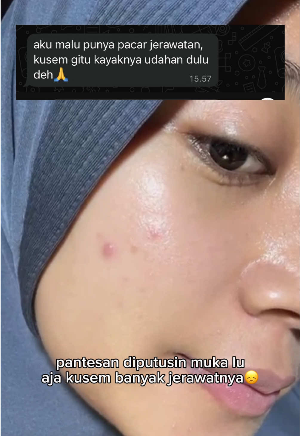 @anisaa𐙚