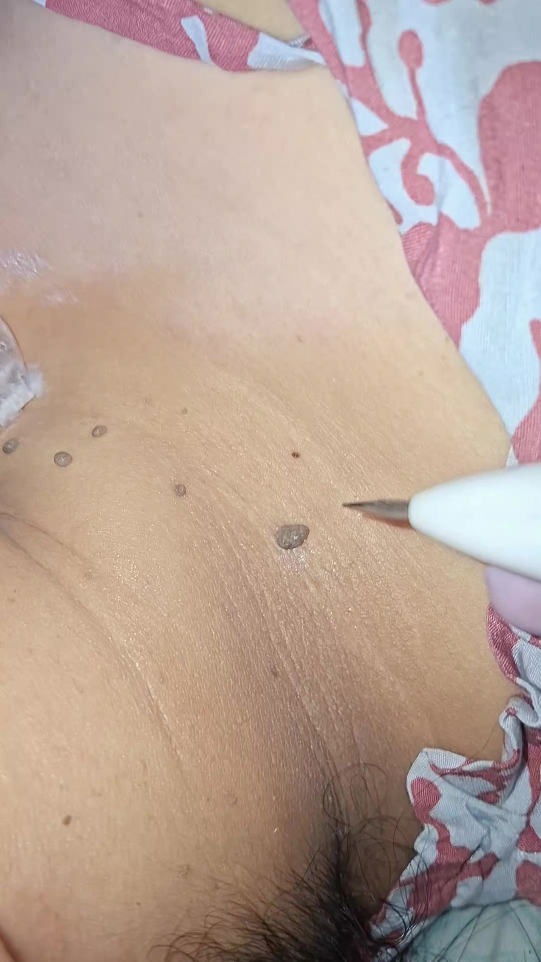@Ersimode