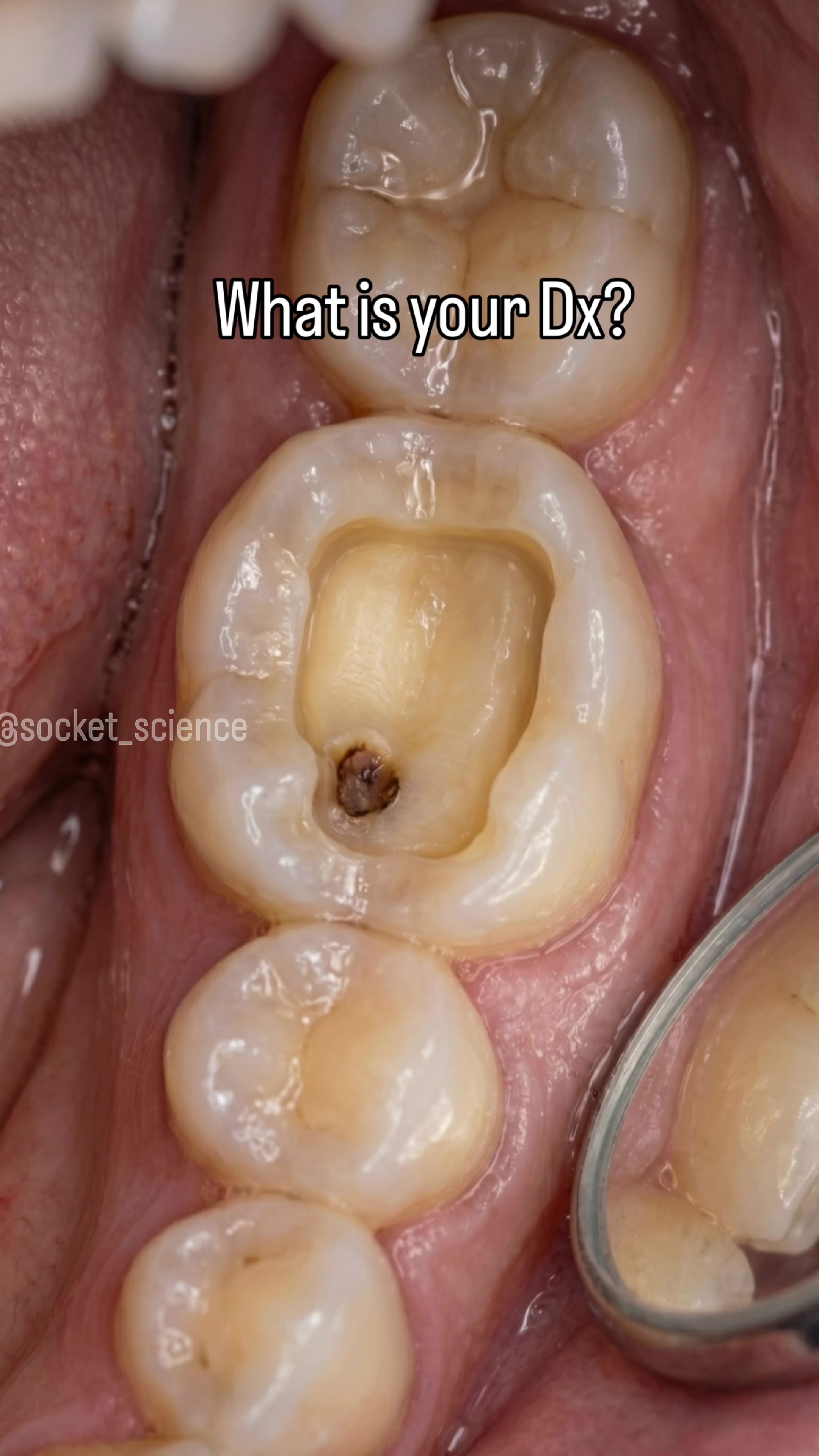 @Socket Science | Dental Visual