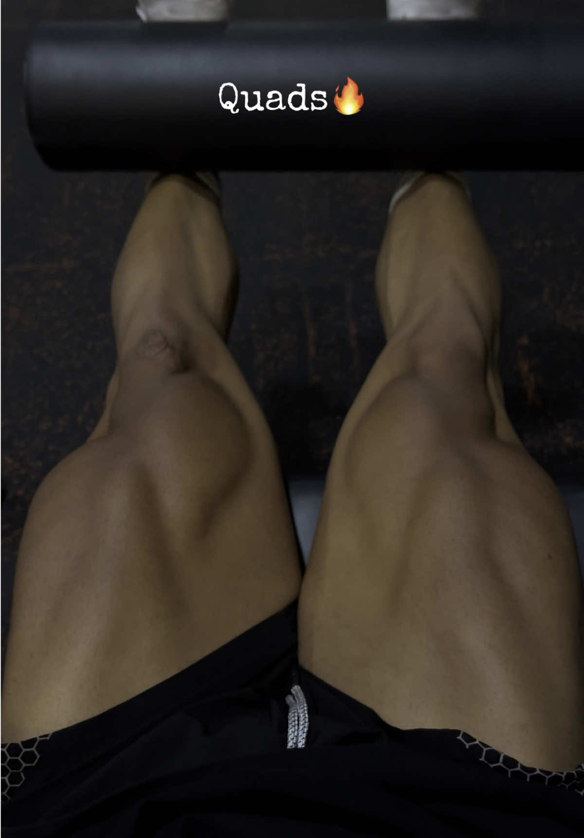 @Estebancossio_