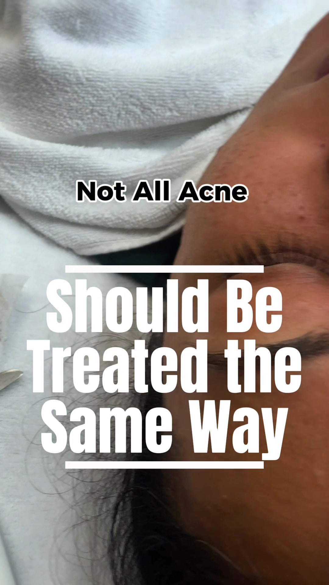 @Andrea | Acne Specialist Jax