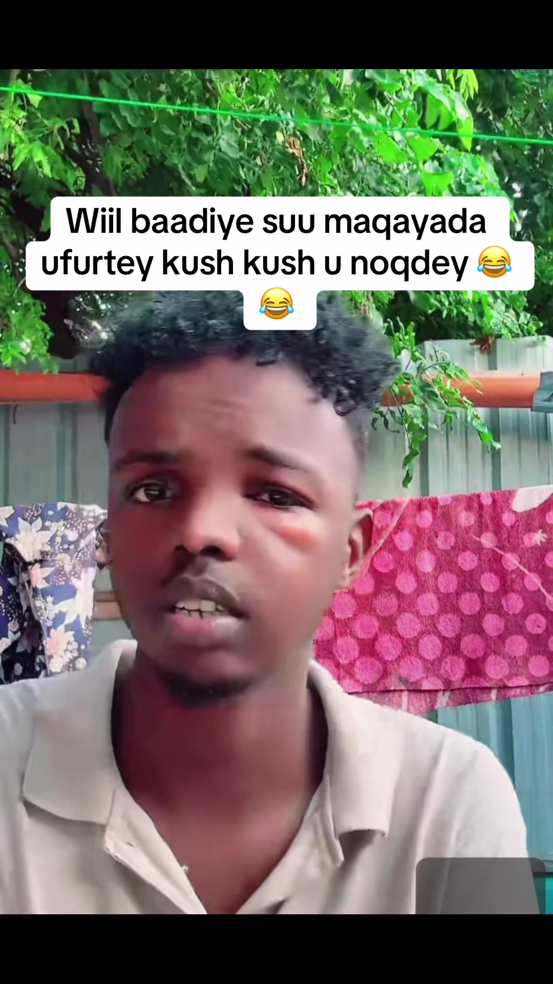 @Ruuney💎🇸🇴