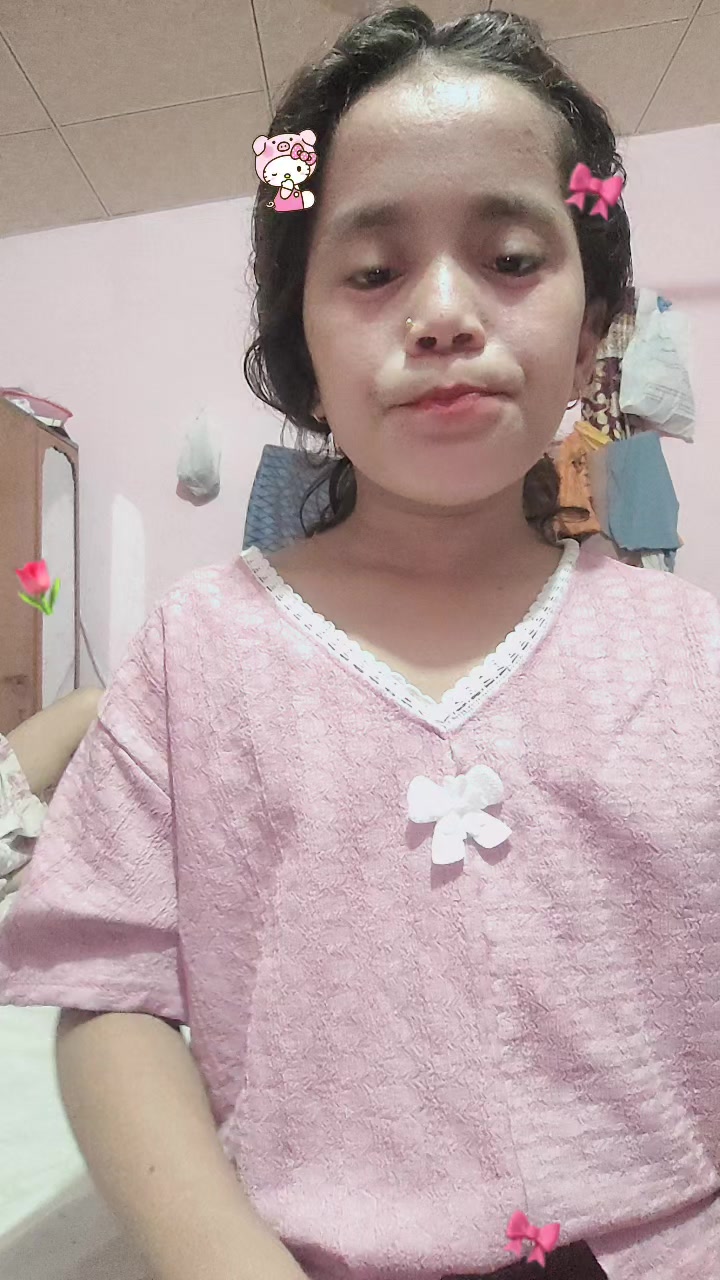 @Gaura Dhamala