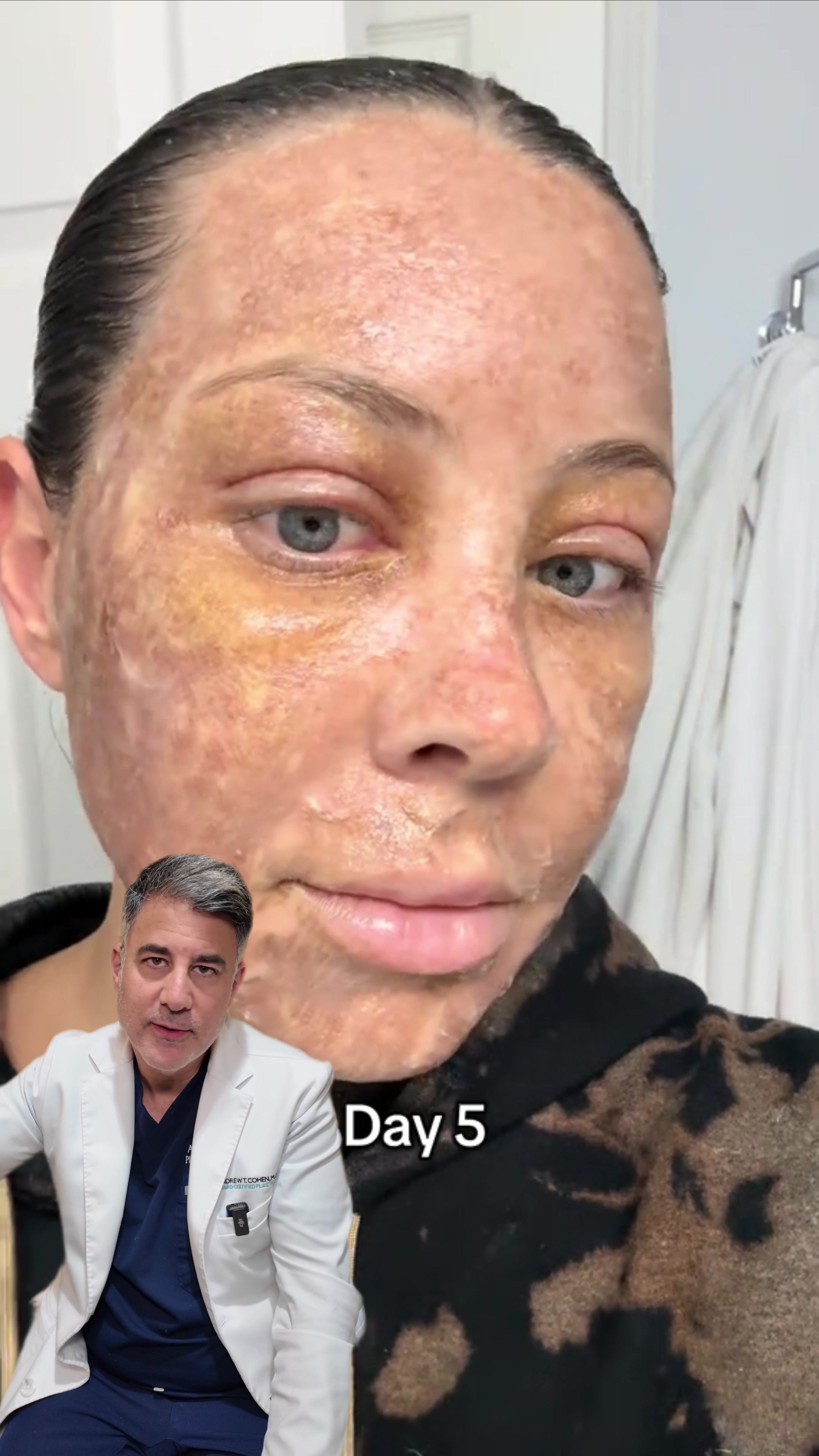 @Cohen MD Plastic Surgery