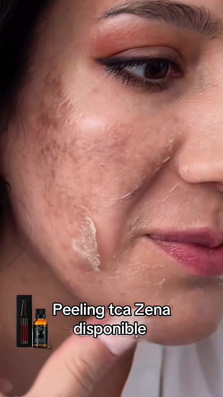 @peeling_zena