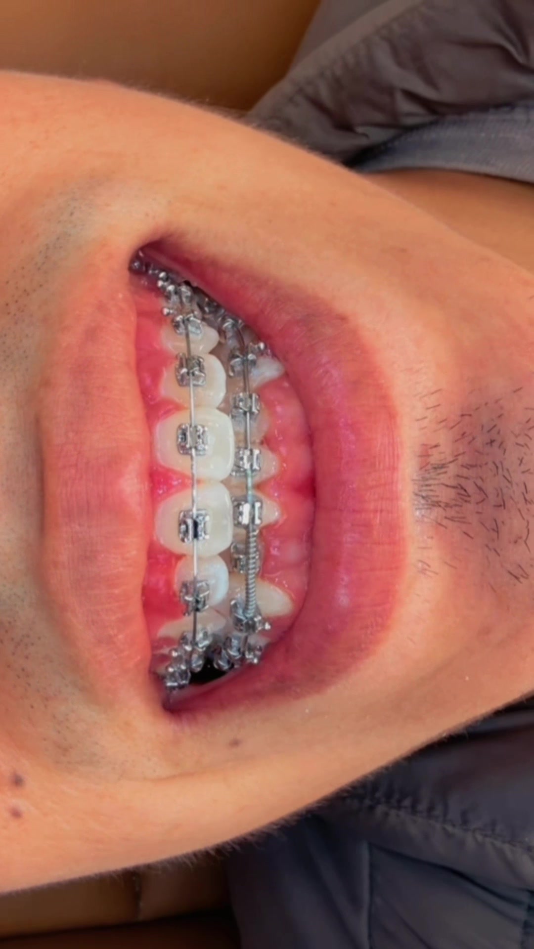 @Más Sonrisas