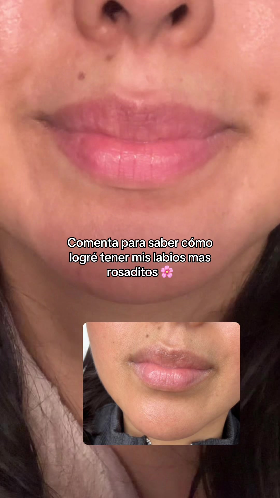 @Carla Panchana