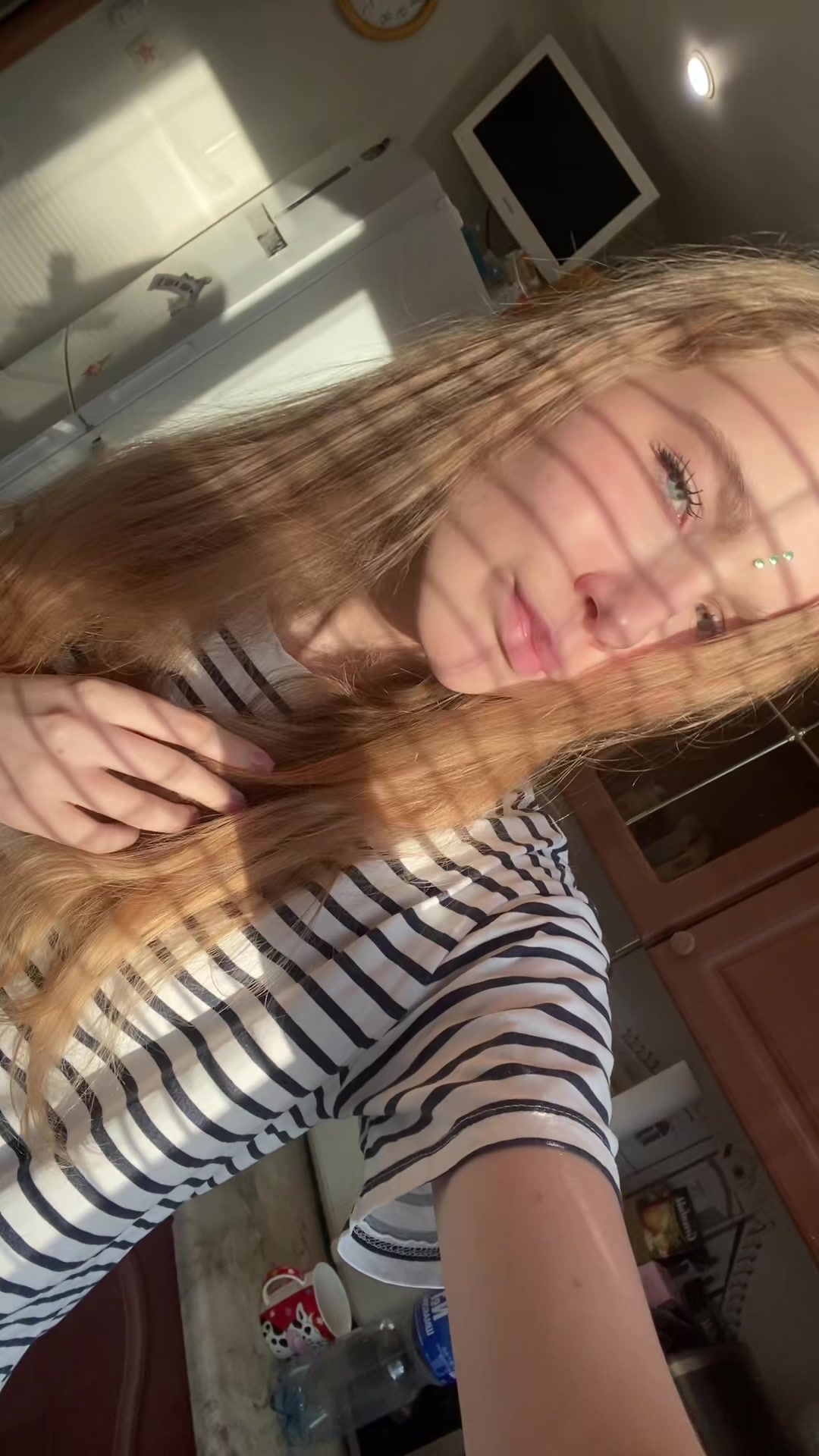 @scarred_arms