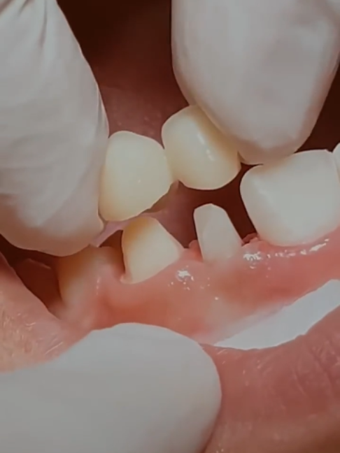 @Tech Dental