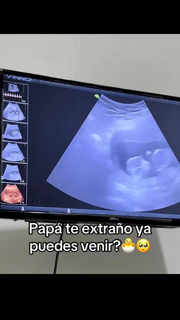 @Iris Cristal García Ocampo