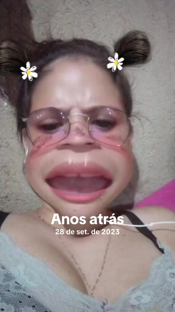 @Erlane Dos Santos