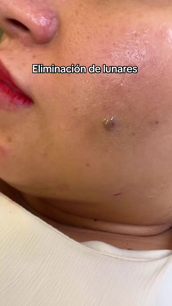 @Angie Ramos