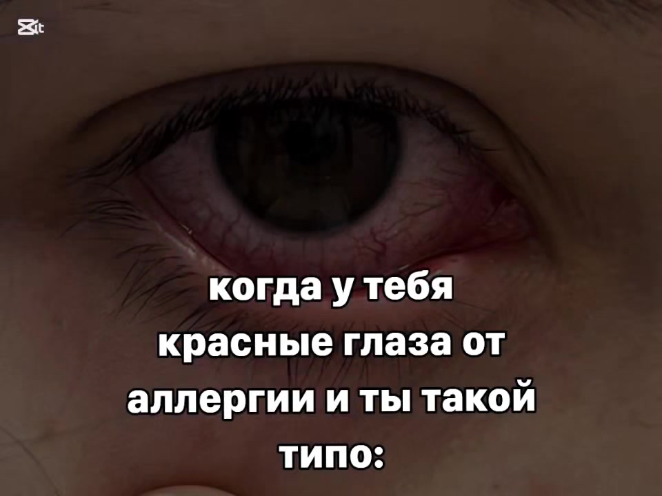 @Алдини