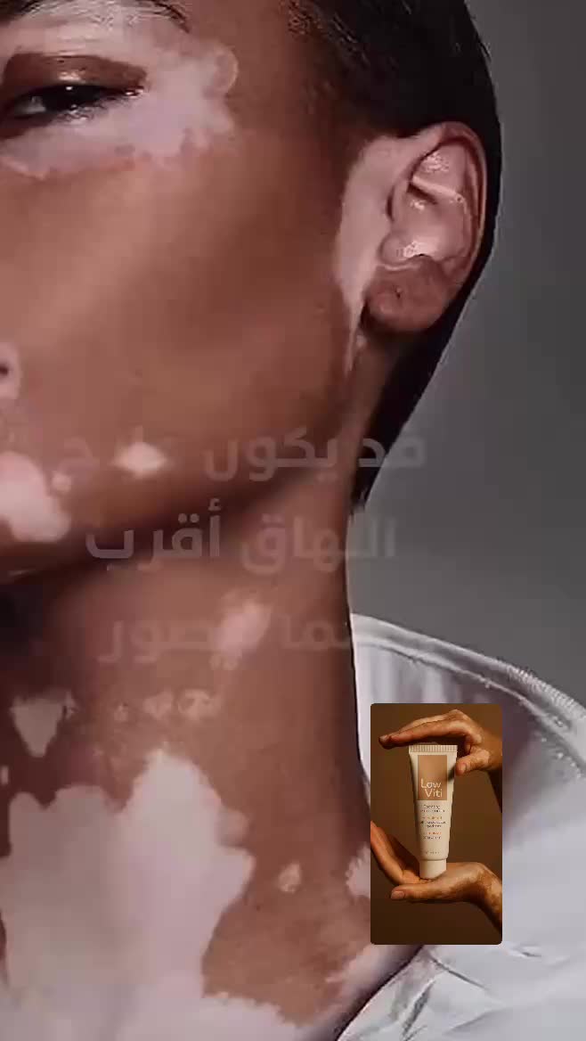 @LowViti