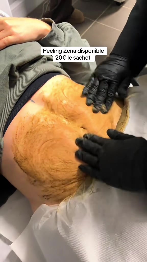 @peeling_zena